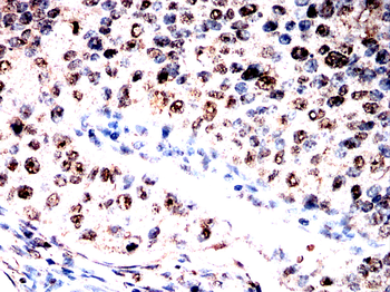 DHODH Antibody