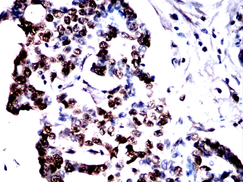 DHODH Antibody