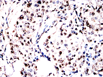 DHODH Antibody