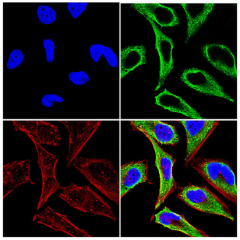 DHODH Antibody