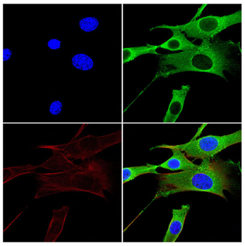 CCN1 Antibody