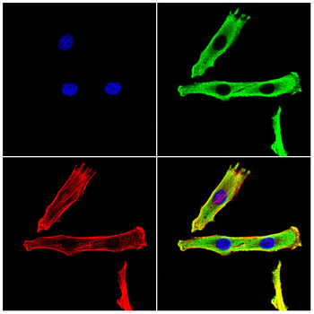 UBE2I Antibody