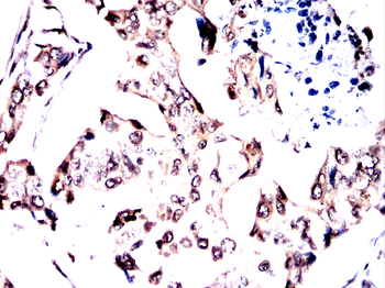 UBE2I Antibody