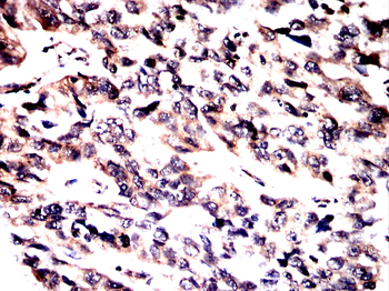 UBE2I Antibody