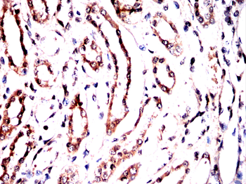 UBE2I Antibody