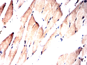 UBE2I Antibody