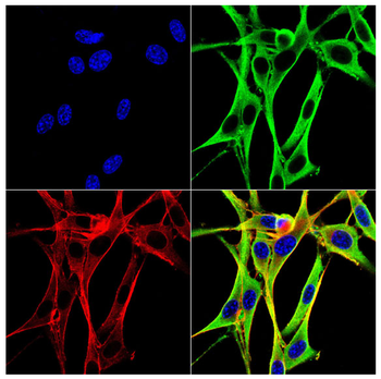 UBE2I Antibody