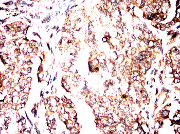 SCARB2 Antibody
