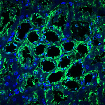SCARB2 Antibody
