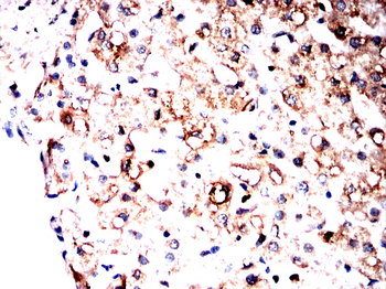 SCARB2 Antibody