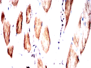 SCARB2 Antibody