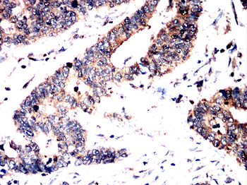 SCARB2 Antibody