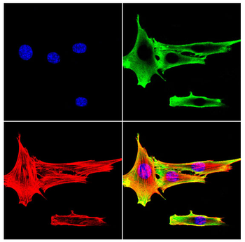 SOD1 Antibody