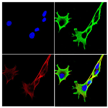 SOD1 Antibody