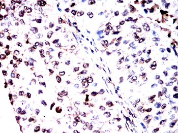 SOD1 Antibody