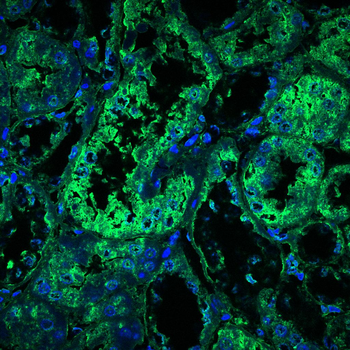 SOD1 Antibody