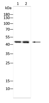 ACP3 Antibody