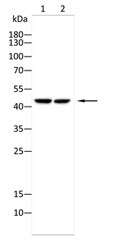 ACP3 Antibody