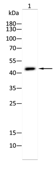 ACP3 Antibody