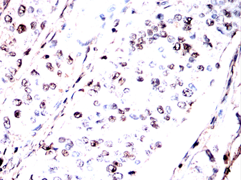 EPAS1 Antibody
