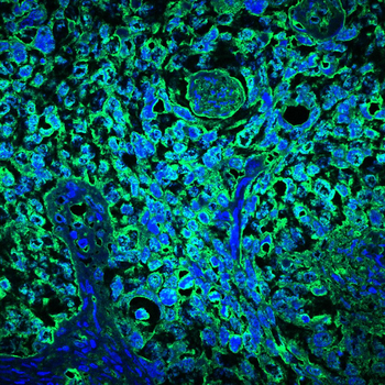 EPAS1 Antibody