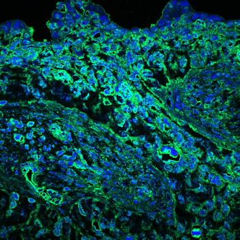 EPAS1 Antibody
