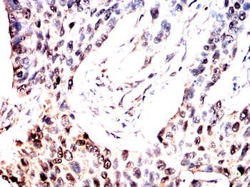 EPAS1 Antibody