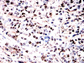 EPAS1 Antibody