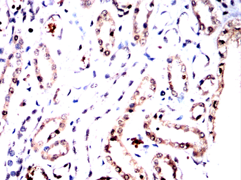 EPAS1 Antibody