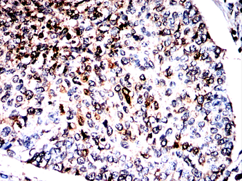EPAS1 Antibody
