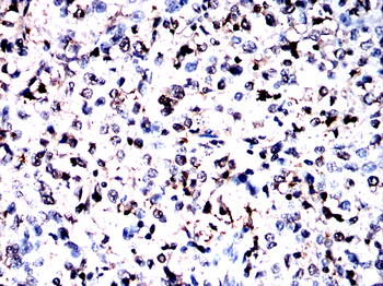 EPAS1 Antibody