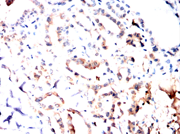 EPAS1 Antibody