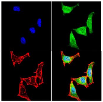 MRTFA Antibody