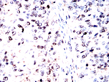 MRTFA Antibody