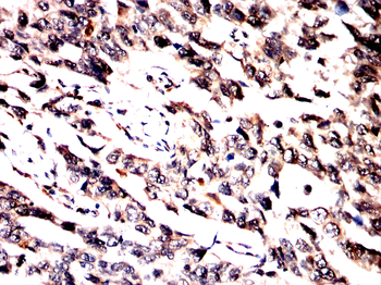 MRTFA Antibody