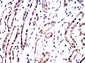 MRTFA Antibody