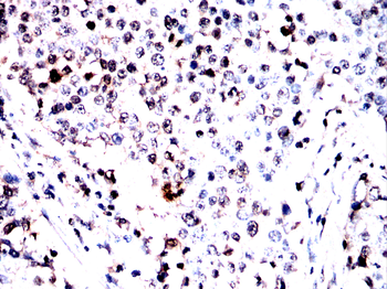 MRTFA Antibody