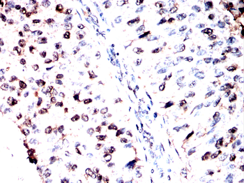 MRTFA Antibody