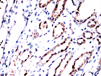 MRTFA Antibody
