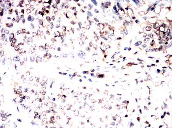 MRTFA Antibody