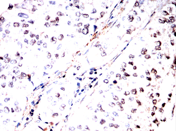 NR2F2 Antibody