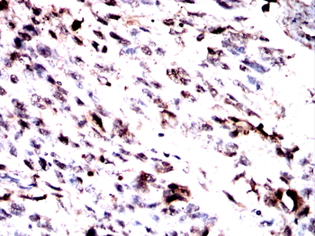 NR2F2 Antibody