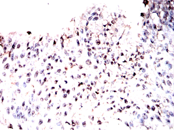 NR2F2 Antibody