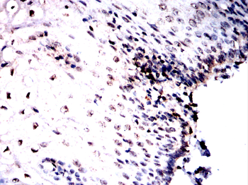 NR2F2 Antibody