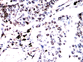 ACOD1 Antibody