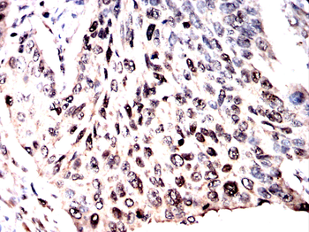 ACOD1 Antibody