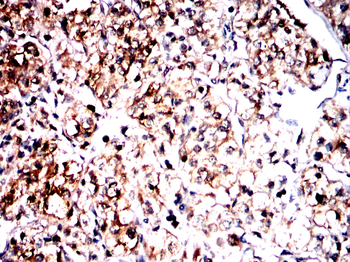 ACOD1 Antibody