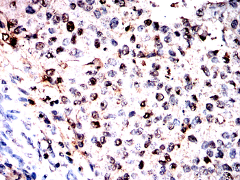 ACOD1 Antibody