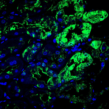 ACOD1 Antibody