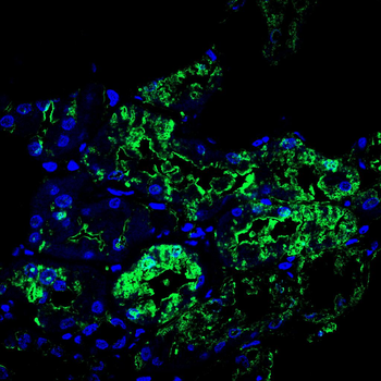 ACOD1 Antibody